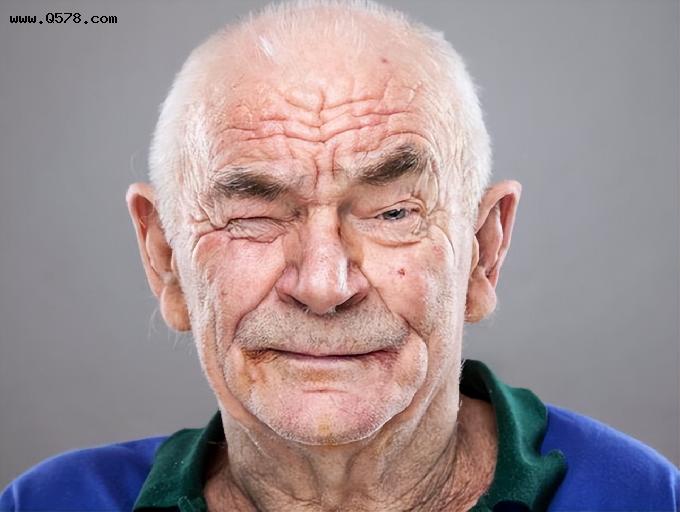 男人50岁后眉毛变长，意味着什么呢？医生说出原因，建议了解