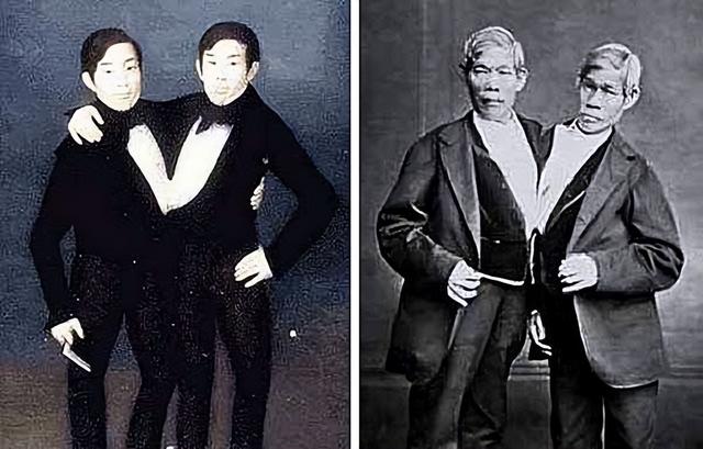 美国连体兄弟结婚生子 连体人如何结婚生子？19世纪泰国兄弟娶了亲姐妹花，生了22个孩子
