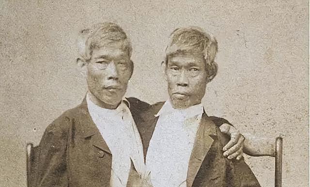 美国连体兄弟结婚生子 连体人如何结婚生子？19世纪泰国兄弟娶了亲姐妹花，生了22个孩子