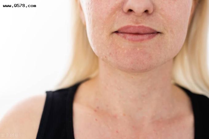 皮肤开始衰老，往往会发出这六个信号，日常护肤，就要加倍用心了