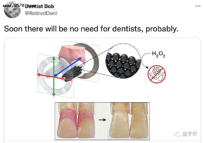懒得刷牙？微型机器人自动帮你搞定，还能牙刷牙线随时变换