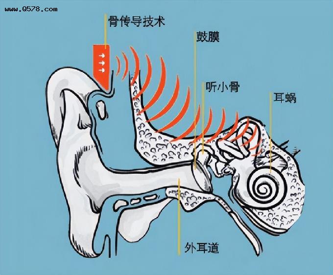 什么是骨传导蓝牙耳机、骨传导耳机是怎么传声的