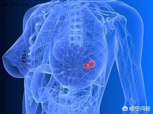 乳腺癌偏晚期，能治好的机率有多大，8次化疗后，做切割手术，以后的生活如何？