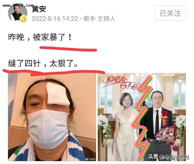 爱国歌手黄安发文称被蔡英文“家暴”缝四针，三天前才“离婚”