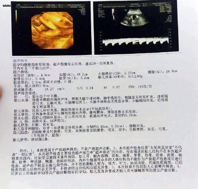 孕检单中藏着胎儿的诸多信息，能看懂这些数据，胎儿就没啥秘密了