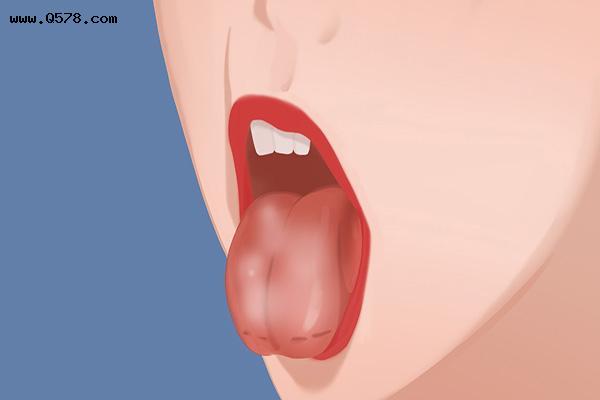 舌头边缘有齿痕，舌苔中间有裂纹？舌象对应着疾病，及时调理