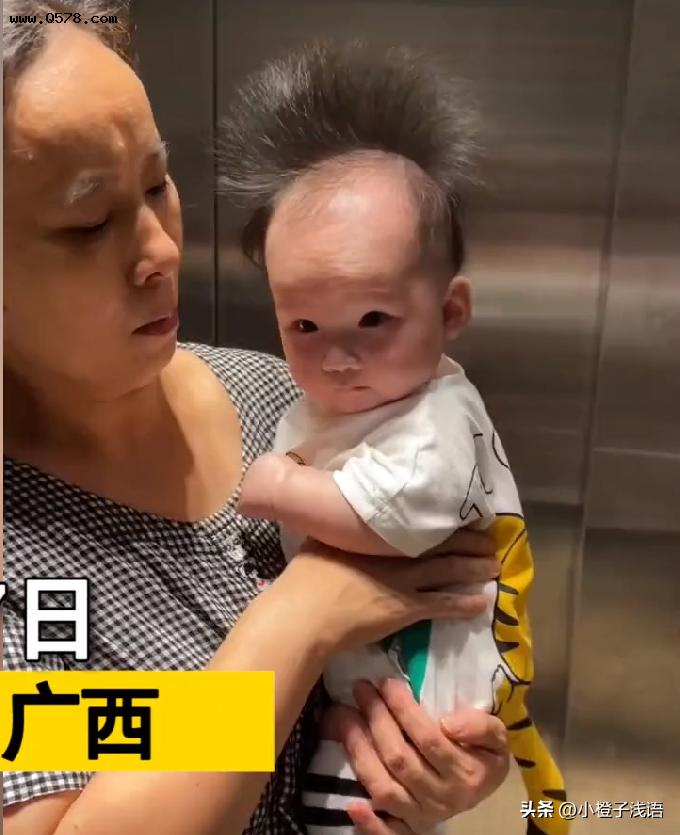 广西4个月宝宝头发直立生长，前面一片秃顶：与生俱来当领导气质