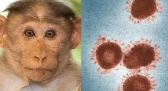 猴痘会死吗?猴痘病毒致死率有多高?