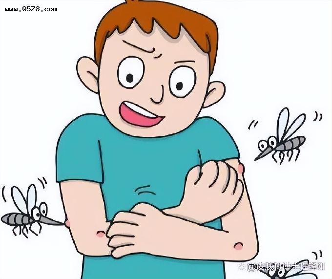 蚊虫叮咬后，如何快速止痒、防搔抓、防留疤？