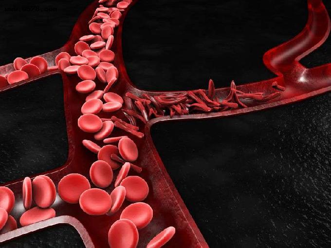 当身体出现3种情况时，你的血液可能发生了黏稠，需及时调理