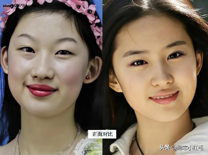 19岁少女耗资百万整成刘亦菲，整容前后的照片对比，让人看得惋惜