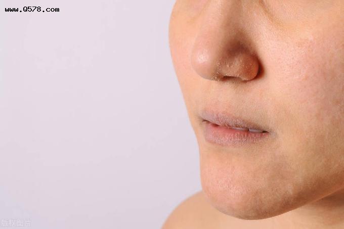 过敏性鼻炎用生理盐水洗鼻子有效果吗 过敏性鼻炎怎样脱敏治疗呢